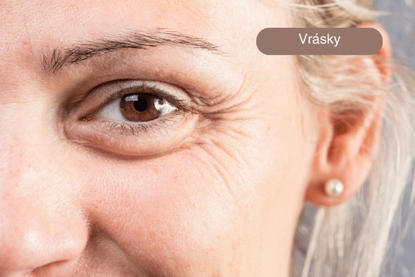 vrásky kosmetika Praha 9