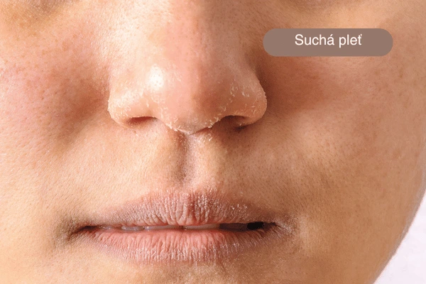 suchá pleť kosmetika Praha